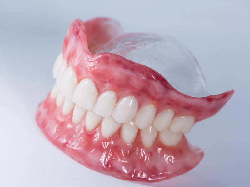 Complete-Dentures