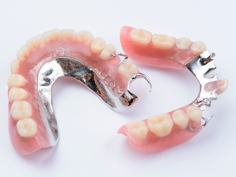 Partial-Dentures